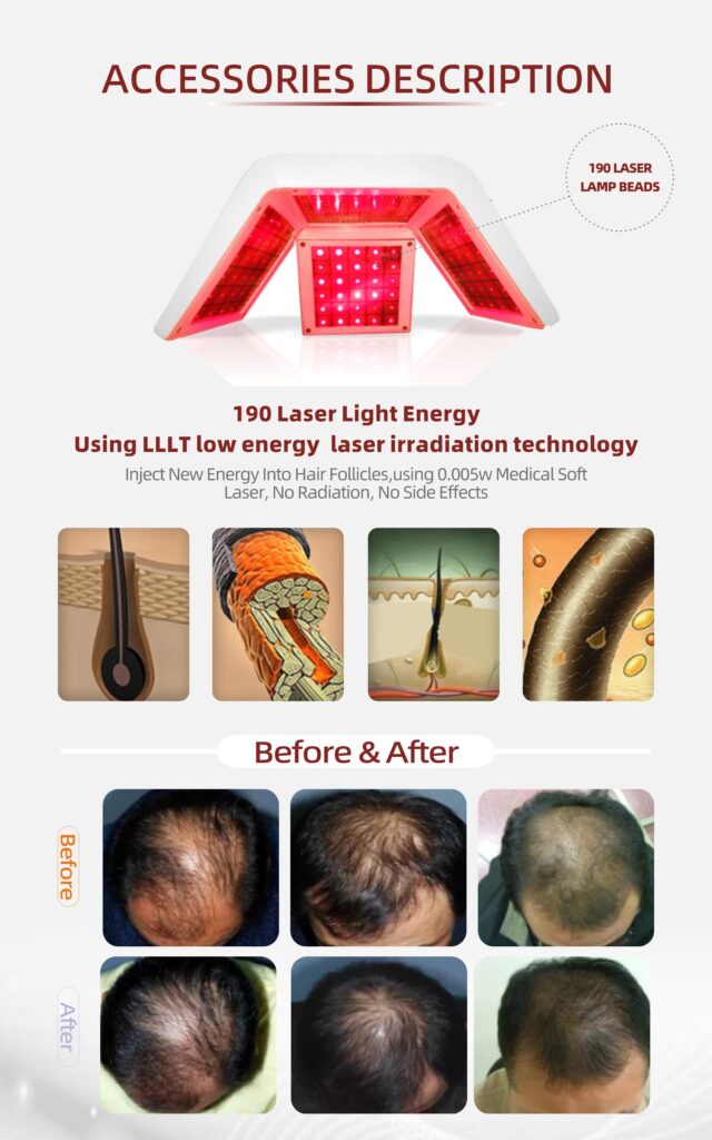 professional hair loss machine treatment helment