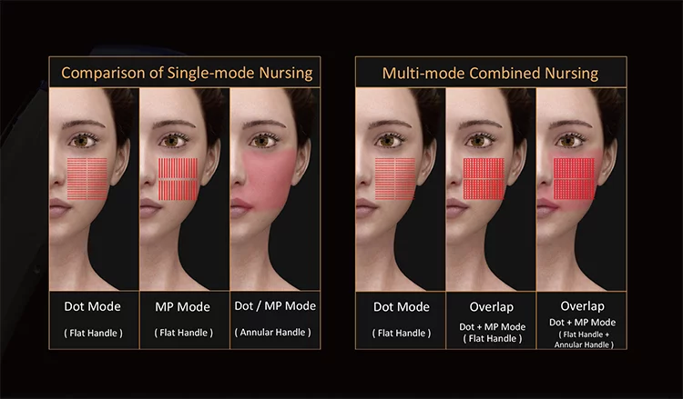 CE approval 4mhz 7mhz anti aging face lift machine 2d hifu